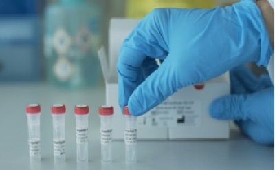 29894 تولید کیت‌ تشخیصی ویروس HPV / ایران در تولید کیت‌های تشخیص بیماری های عفونی بی‌نیاز می‌شود